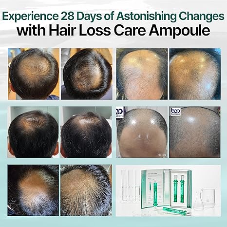 bao h lab hairloss ampoules before and after